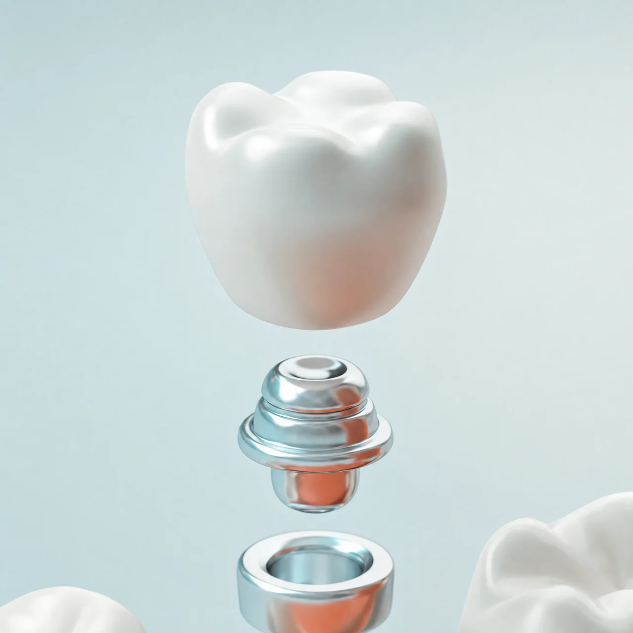 Procedimiento odontológico de implantes